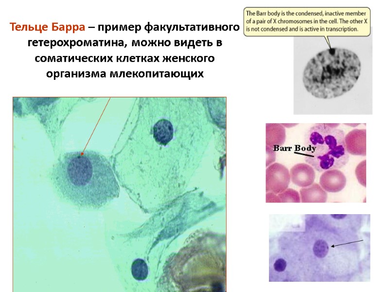 Тельце Барра – пример факультативного гетерохроматина, можно видеть в соматических клетках женского организма млекопитающих